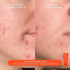 Beauty
SOS Rescue Bestsellers Kit