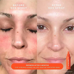 Beauty
SOS Rescue Bestsellers Kit